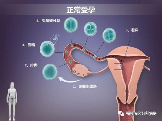 我该如何拯救你——迷路的受精卵?